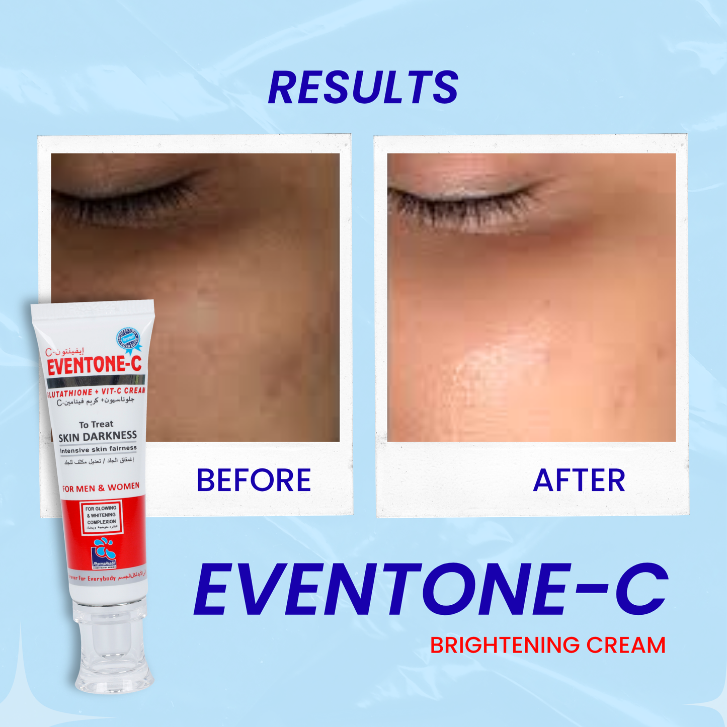 Eventone C Cream 30ml