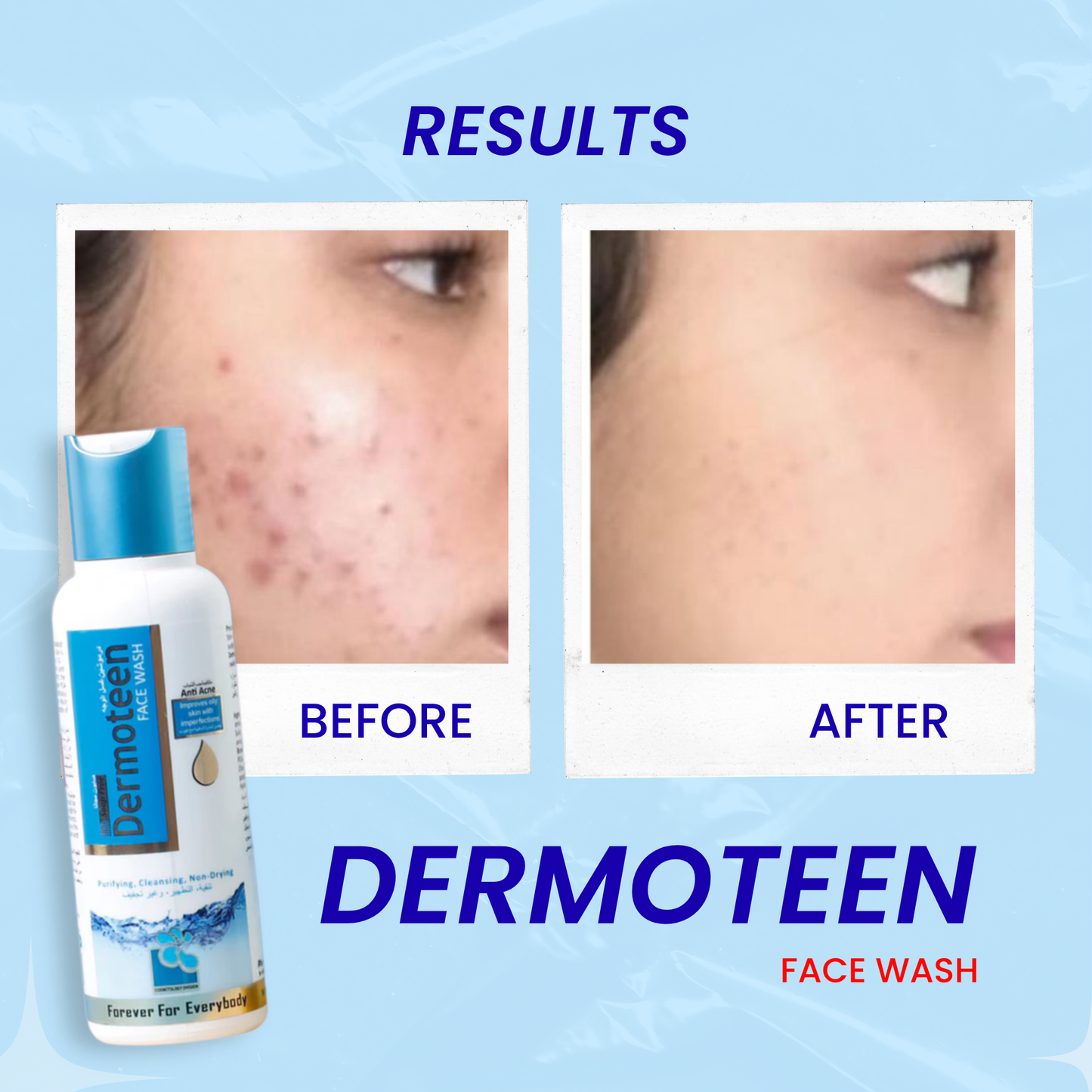 Dermoteen Anti Acne Face Wash 100ml