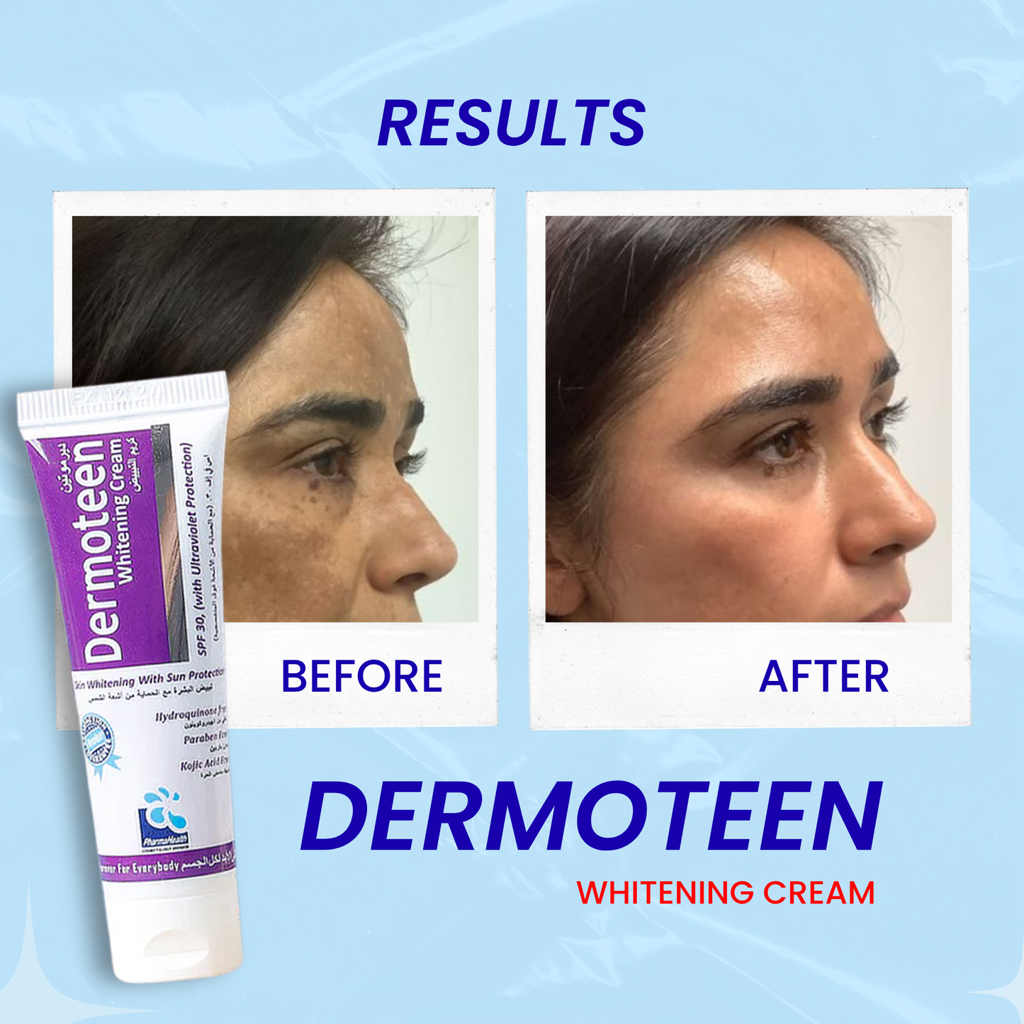 Dermoteen Whitening Cream 20ml