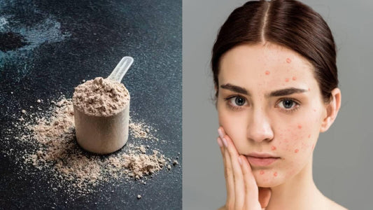 Protein Shakes for Acne-Prone Skin